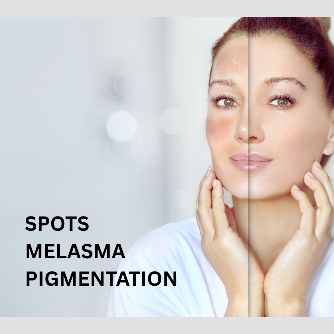9. Pigmentation