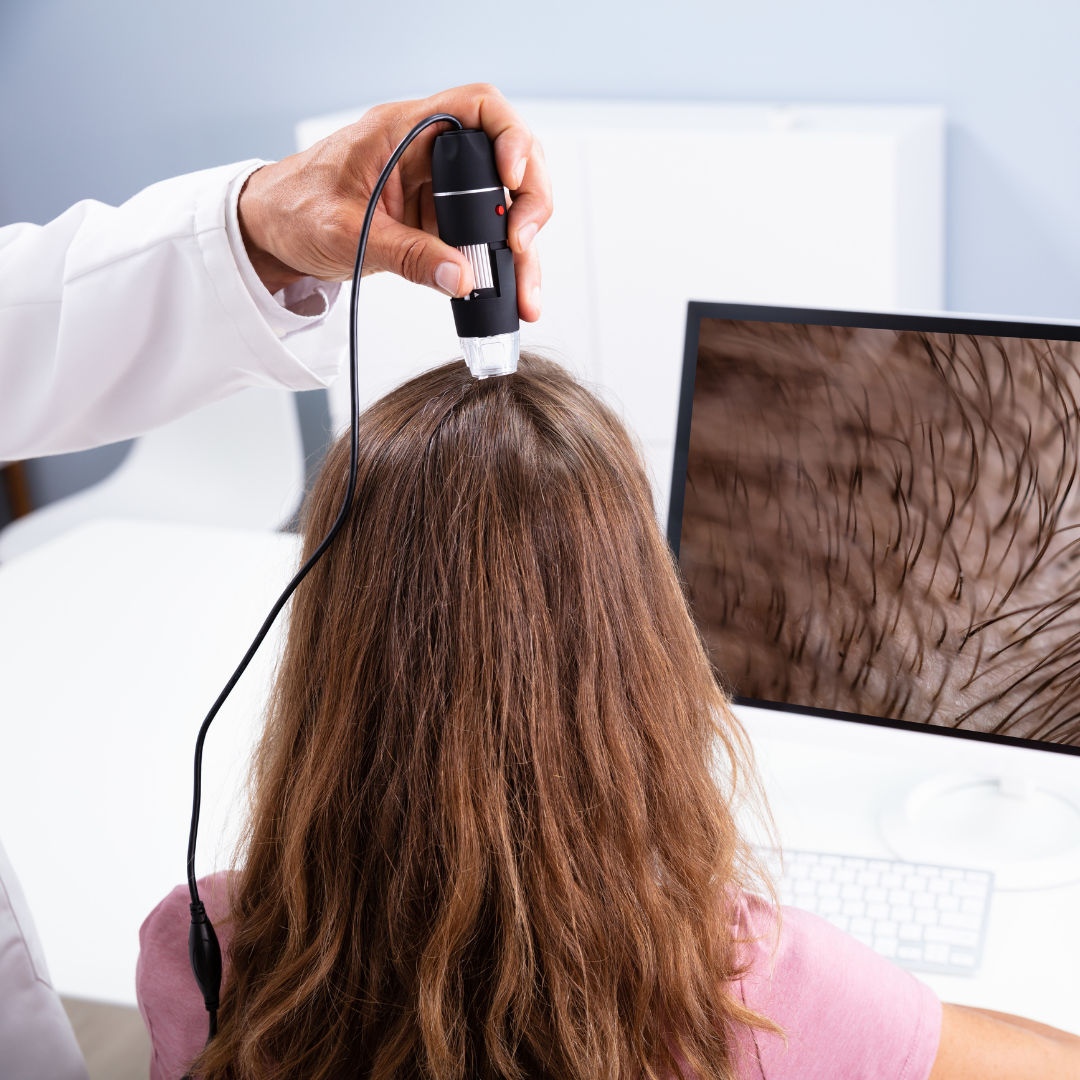 2. Natural Alopecia Treatment