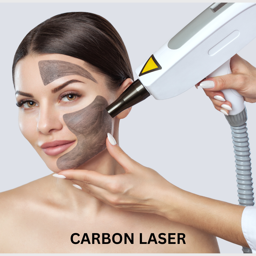 4. Carbon Laser