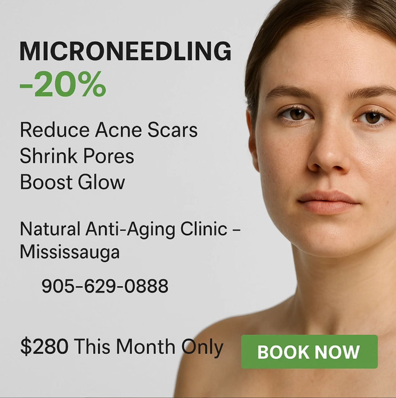 Microneedling Mississauga